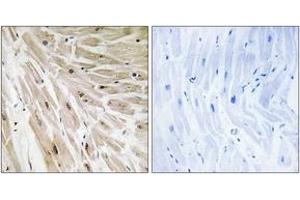 Immunohistochemistry (IHC) image for anti-Ribosomal Protein L22 (RPL22) (AA 51-100) antibody (ABIN2890073) (RPL22 Antikörper  (AA 51-100))