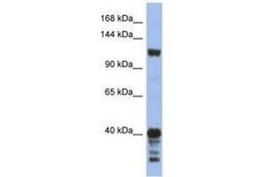 Image no. 1 for anti-Signal-Induced Proliferation-Associated 1 (SIPA1) (AA 863-912) antibody (ABIN6744322) (SIPA1 Antikörper  (AA 863-912))