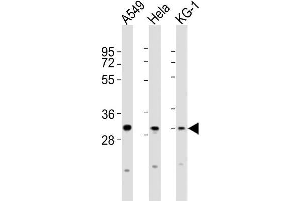 PYCRL Antikörper  (C-Term)