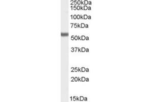 Western Blotting (WB) image for anti-Forkhead Box C1 (FOXC1) (C-Term) antibody (ABIN2465707) (FOXC1 Antikörper  (C-Term))