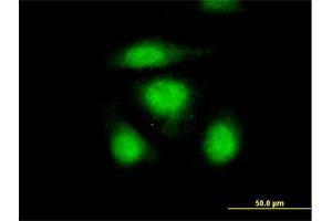 Immunofluorescence of purified MaxPab antibody to OSTF1 on HeLa cell. (OSTF1 Antikörper  (AA 1-217))