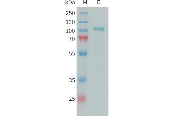 C1S Protein (AA 16-688) (His tag)