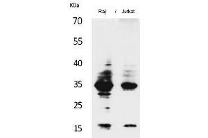 Western Blot analysis of Raji, Jurkat cells using IL-4 Polyclonal Antibody. (IL-4 Antikörper  (Internal Region))