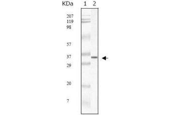 SARS-Coronavirus Membrane Protein (SARS-CoV M) Antikörper