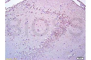 Formalin-fixed and paraffin embedded rat brain tissue labeled with Anti-Brdu Polyclonal Antibody, Unconjugated (ABIN729808) at 1:200, followed by conjugation to the secondary antibody and DAB staining (BrdU Antikörper)