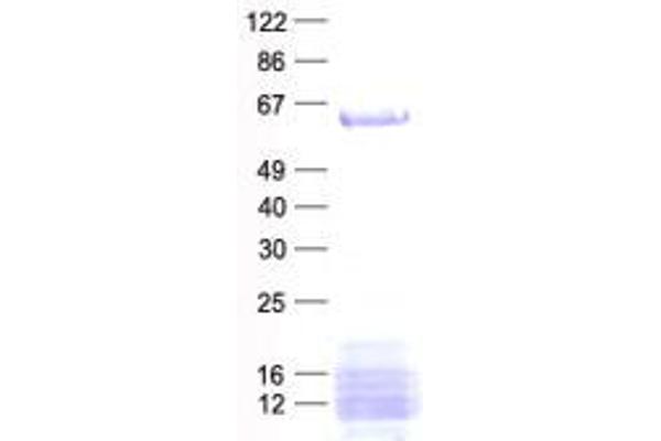 AGFG1 Protein (His tag)