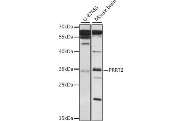 PRRT2 Antikörper  (AA 20-130)