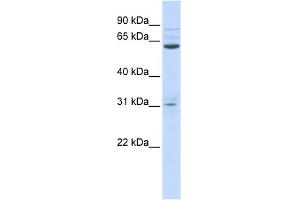 WB Suggested Anti-ISX Antibody Titration:  0. (ISX Antikörper  (N-Term))