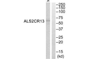 Western Blotting (WB) image for anti-Family with Sequence Similarity 117, Member B (FAM117B) (C-Term) antibody (ABIN1850760) (FAM117B Antikörper  (C-Term))