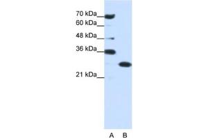 Western Blotting (WB) image for anti-Acidic (Leucine-Rich) Nuclear phosphoprotein 32 Family, Member A (ANP32A) antibody (ABIN2462045) (PHAP1 Antikörper)
