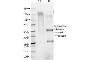 Formalin-fixed, paraffin-embedded human Cervix stained with CD44 Recombinant Mouse Monoclonal Antibody (rHCAM/918). (Rekombinanter CD44 Antikörper)