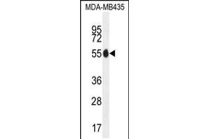 Western blot analysis in MDA-MB435 cell line lysates (35ug/lane). (PAX1 Antikörper  (N-Term))