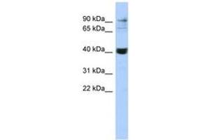 Image no. 1 for anti-Matrix Metallopeptidase 3 (Stromelysin 1, Progelatinase) (MMP3) (C-Term) antibody (ABIN6743087) (MMP3 Antikörper  (C-Term))