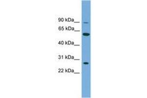 Image no. 1 for anti-IMP (Inosine 5'-Monophosphate) Dehydrogenase 2 (IMPDH2) (N-Term) antibody (ABIN6745056) (IMPDH2 Antikörper  (N-Term))