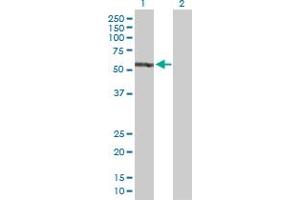 Lane 1: EPB41 transfected lysate ( 81. (EPB41 293T Cell Transient Overexpression Lysate(Denatured))