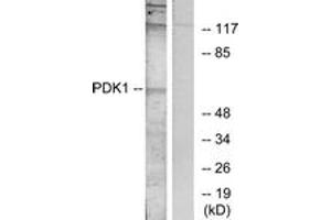 Western Blotting (WB) image for anti-3-phosphoinositide Dependent Protein Kinase-1 (PDPK1) (AA 210-259) antibody (ABIN2889054) (PDPK1 Antikörper  (AA 210-259))