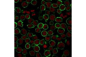 Immunofluorescence (IF) image for anti-Sialophorin (SPN) antibody (ABIN6940632)