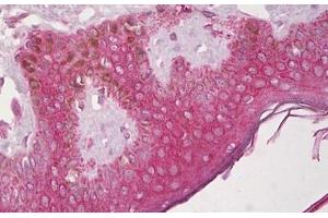 Anti-CXCR4 antibody IHC staining of human skin, epidermis. (CXCR4 Antikörper  (N-Term))