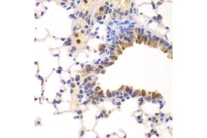 Immunohistochemistry of paraffin-embedded mouse lung using NFKB1 antibody at dilution of 1:200 (400x lens). (NFKB1 Antikörper)
