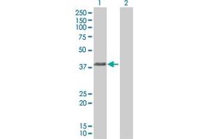 Western Blotting (WB) image for HLA-E 293T Cell Transient Overexpression Lysate(Denatured) (ABIN1332151)