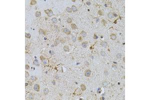 Immunohistochemistry of paraffin-embedded mouse brain using NAT8 antibody. (NAT8 Antikörper)