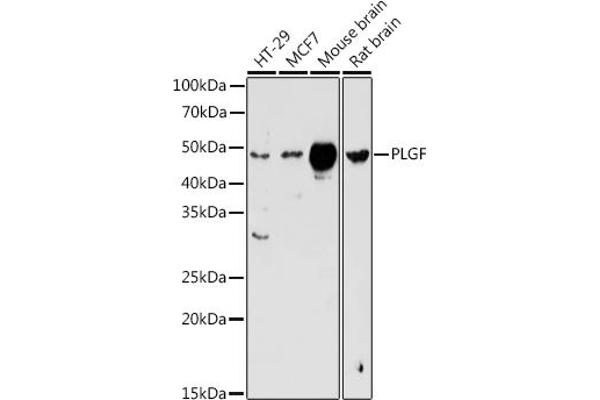 PLGF Antikörper  (AA 19-170)