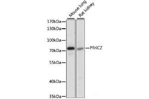 Western blot analysis of extracts of various cell lines using PRKCZ Polyclonal Antibody at dilution of 1:1000. (PKC zeta Antikörper)