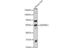 Western blot analysis of extracts of Mouse liver, using SERPINF2 antibody  at 1:1000 dilution. (alpha 2 Antiplasmin Antikörper  (AA 302-491))