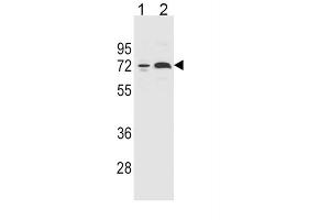 Western Blotting (WB) image for anti-Cytochrome P450, Family 2, Subfamily B, Polypeptide 6 (CYP2B6) antibody (ABIN5015645) (CYP2B6 Antikörper)