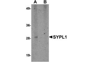 Western blot analysis of SYPL1 in human brain tissue lysate with this product at 1 μg/ml in (A) the absence and (B) the presence of blocking peptide. (SYPL1 Antikörper  (N-Term))