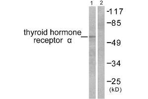Western Blotting (WB) image for anti-Thyroid Hormone Receptor, alpha (THRA) (N-Term) antibody (ABIN1848805) (THRA Antikörper  (N-Term))