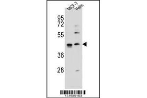 Western blot analysis in MCF-7,Hela cell line lysates (35ug/lane). (ZNF384 Antikörper  (C-Term))