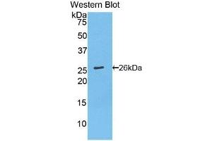 Detection of Recombinant Bcl2, Mouse using Polyclonal Antibody to B-Cell Leukemia/Lymphoma 2 (Bcl2) (Bcl-2 Antikörper  (AA 2-208))