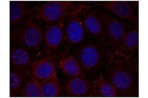 Image no. 1 for anti-Insulin-Like Growth Factor 1 Receptor (IGF1R) (pTyr1165), (pTyr1166) antibody (ABIN196774) (IGF1R Antikörper  (pTyr1165, pTyr1166))