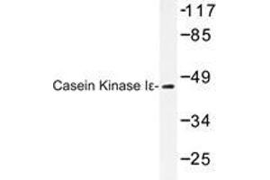 Western blot analysis of Casein Kinase Iε antibody in extracts from LOVO cells. (CK1 epsilon Antikörper)