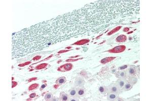 Human Placenta, Amnion: Formalin-Fixed, Paraffin-Embedded (FFPE) (TADA2L Antikörper  (Internal Region))