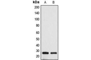 Western blot analysis of BAK expression in HeLa (A), A431 (B) whole cell lysates. (BAK1 Antikörper  (N-Term))