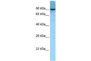 WB Suggested Anti-Aacs Antibody Titration: 1. (AACS Antikörper  (Middle Region))
