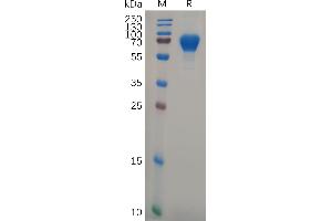 Human GP6 Protein, hFc Tag on SDS-PAGE under reducing condition. (GP6 Protein (AA 21-267) (Fc Tag))