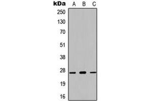 Western blot analysis of Kallikrein 7 expression in HEK293T (A), NS-1 (B), PC12 (C) whole cell lysates. (Kallikrein 7 Antikörper  (N-Term))