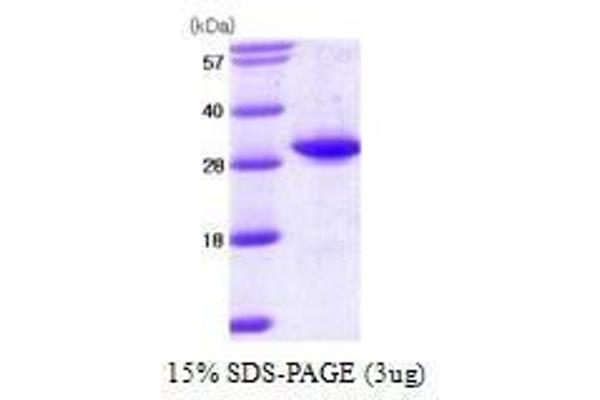 TPMT Protein (AA 1-245)