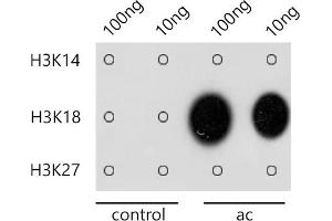 Dot-blot analysis of all sorts of methylation peptides using Acetyl-Histone H3-K18 antibody (ABIN7267668) at 1:1000 dilution. (Histone 3 Antikörper  (H3K18))