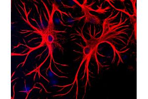 Mixed cultures of neurons and glia stained with chicken anti-GFAP (red), and DNA (blue). (GFAP Antikörper)