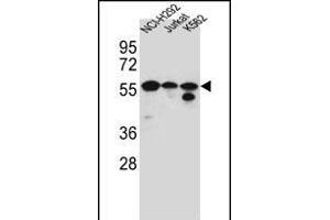 FOXN2 Antibody (N-term) (ABIN656184 and ABIN2845513) western blot analysis in NCI-,Jurkat,K562 cell line lysates (35 μg/lane). (FOXN2 Antikörper  (N-Term))