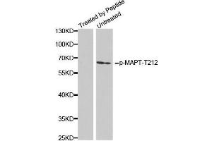Western Blotting (WB) image for anti-Microtubule-Associated Protein tau (MAPT) (pThr212) antibody (ABIN3020349) (MAPT Antikörper  (pThr212))