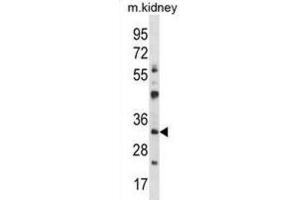 Western Blotting (WB) image for anti-General Transcription Factor IIB (GTF2B) antibody (ABIN2997924) (GTF2B Antikörper)