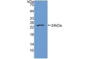 Detection of Recombinant GAS6, Human using Polyclonal Antibody to Growth Arrest Specific Protein 6 (GAS6) (GAS6 Antikörper  (AA 136-311))