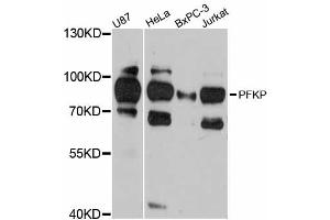 Western blot analysis of extracts of various cell lines, using PFKP antibody (ABIN5998500) at 1:3000 dilution. (PFKP Antikörper)