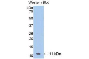 Western Blotting (WB) image for anti-Pro-Platelet Basic Protein (Chemokine (C-X-C Motif) Ligand 7) (PPBP) (AA 59-128) antibody (ABIN1858176) (CXCL7 Antikörper  (AA 59-128))