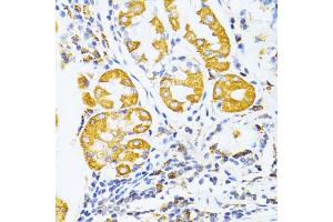 Immunohistochemistry of paraffin-embedded human stomach using MMP2 antibody (ABIN5973678) at dilution of 1/100 (40x lens). (MMP2 Antikörper)